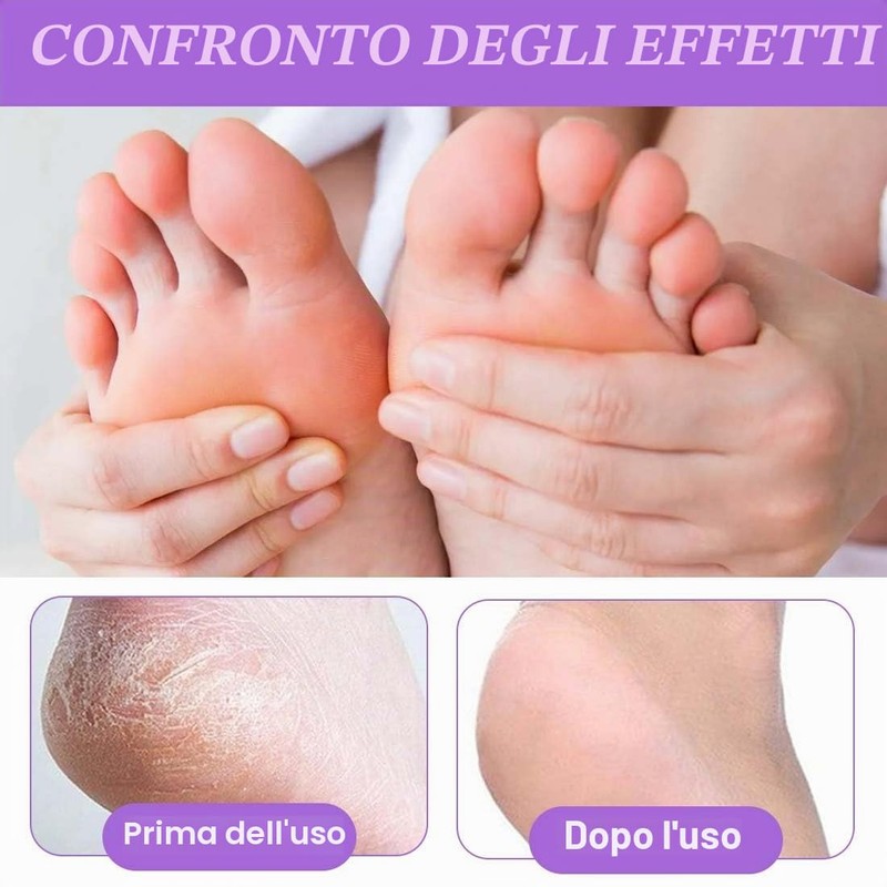 QOCUILC 2 Paia maschera piedi secchi screpolati, Maschera piedi esfoliante,