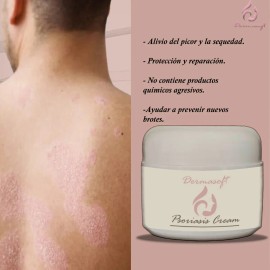 Crema Facial & Corporal Psoriasis Cream Hidratante Aliviante