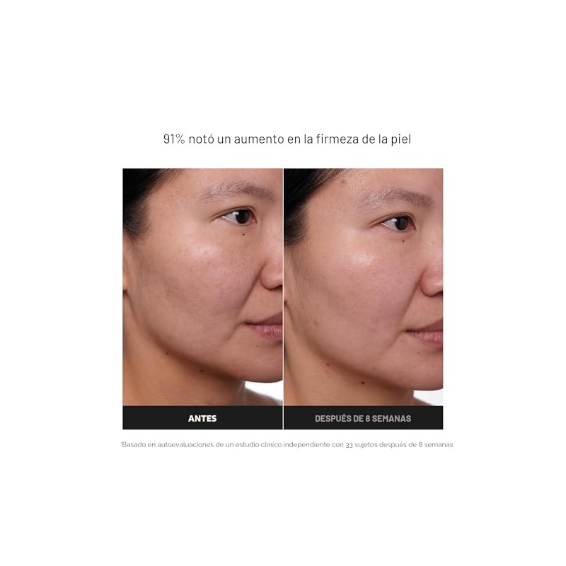 Paula's Choice CLINICAL 1% Retinol Crema Tratamiento