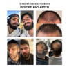 Lightweight Beard Oil ByErim Natural beard growth & nourishing hair