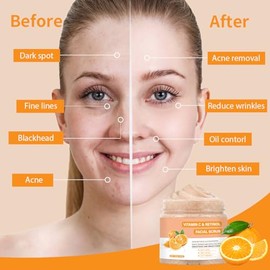 IREV- Exfoliante facial con vitamina C, lavado facial exfoliante con retinol, exfoliante facial, exfoliante facial, exfoliante facial