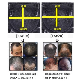 Men's Wig Partial Wig, Men's Whole Wig, Top of Head, Human Hair Top Piece, Point Wig, Bald Hiding, Top Planting, Natural, Breathable, Thin Hair, Top Cover, Gray Hair Hidden Wig Natural Black (7.1 x