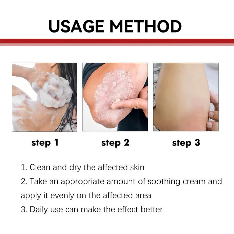 Pomada Herbal Antibacterial para Cuidado de la Piel Sensible Irritación,