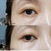 Parches Hydrogel Heimish Rosa Búlgara 100g Contorno Ojos Normal