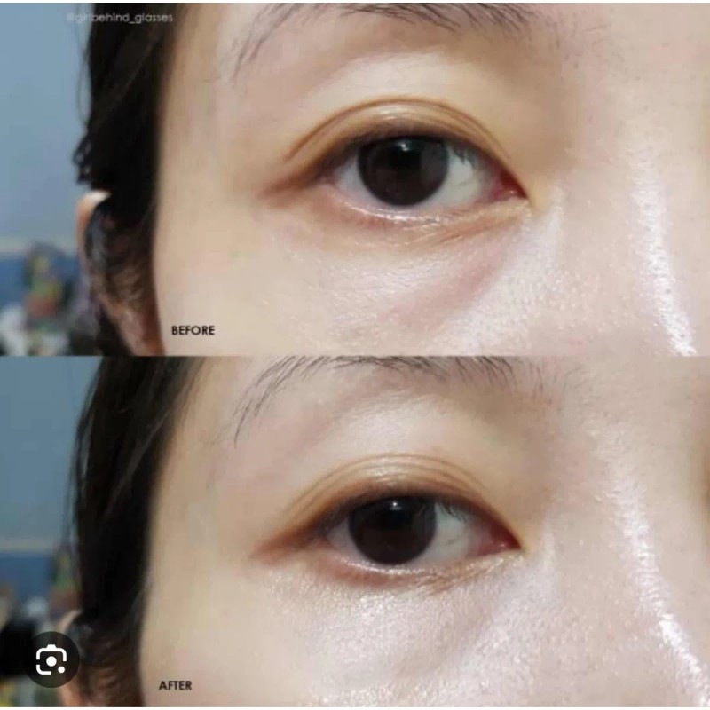 Parches Hydrogel Heimish Rosa Búlgara 100g Contorno Ojos Normal