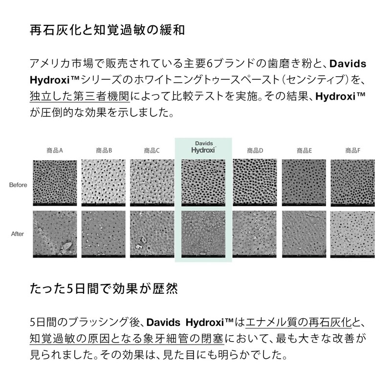 Davids Hydroxi™ Whitening Tooth Paste (Sensitive) 4.5 oz (113 g)
