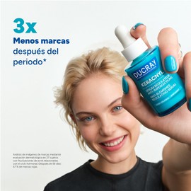 DUCRAY Keracnyl Sérum Regulador Anti-Imperfecciones, Controla brotes de imperfecciones agravados por el ciclo hormonal, la alimentación y el estrés, 30ml