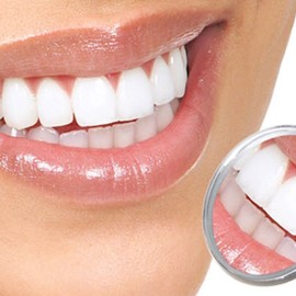 Teeth Whitening at Home Kit with 8 Syringes 35% Tooth Whitening Gel, Mouth Trays and a Tooth Shade Guide