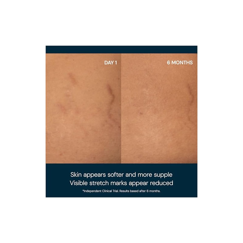 Elemis Aceite corporal de camelia japonesa– Aceite Corporal Nutritivo