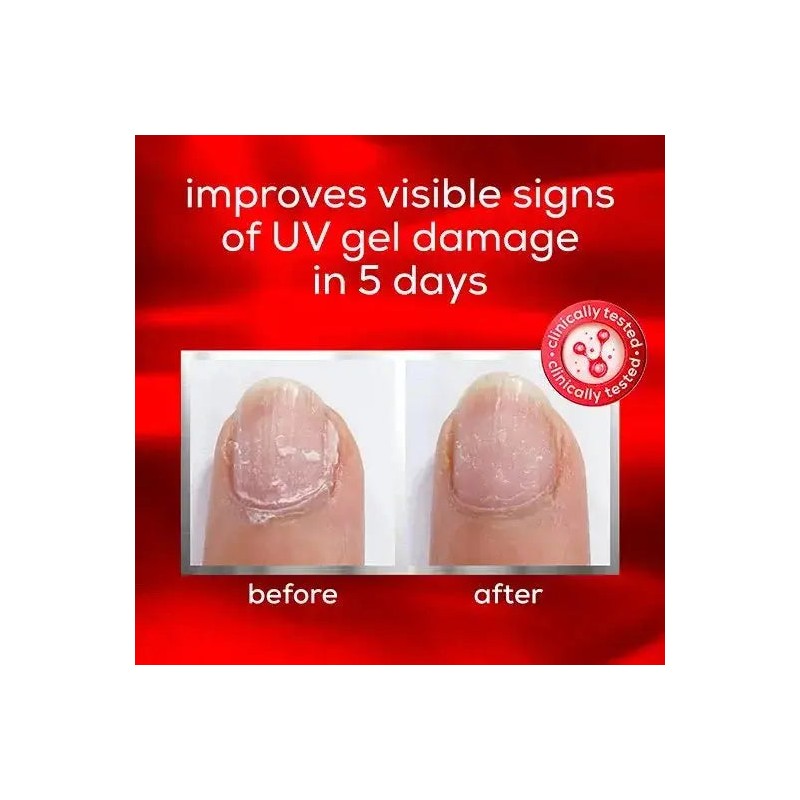 Essie To The Rescue Nail Care