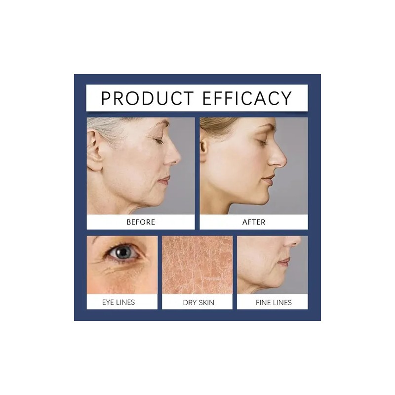 Crema Facial , Crema Removedora De Arrugas Qinglin Pa