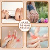 14 Pcs Toe Straighteners for Bent Toes, Hammer Toe Straightener