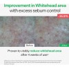 Sérum Torriden Balanceful Control Sebum 50 Ml
