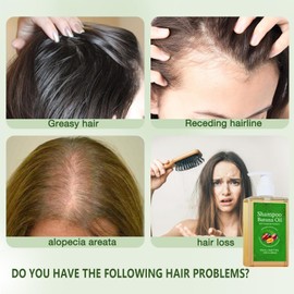 AMUA Batana Oil Shampoo for hair growth, Rosemary Shampoo,Nourishing & Rejuvenating for Softness & Volume, Suitable for Men & Women, Reduces Hair Loss (7.05 fl oz)