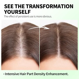 Hair Growth Serum Roll On-3% Rosemary Oil,3% Ginger Extract,Plant-Powered Scalp Serum for Thinning Hair, Hairline & Eyebrow Care,Women & Men