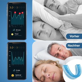 Snoring splint against snoring and crunch, anti-snoring mouth guard (snoring stopper, bite splint) finally snoring free with anti-snoring tooth splint