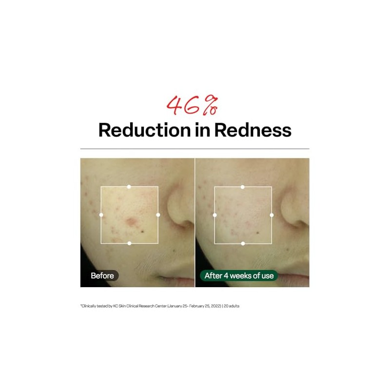 Dr.G NEW RED Blemish Clear Soothing Cream (70ml 2.36 oz)