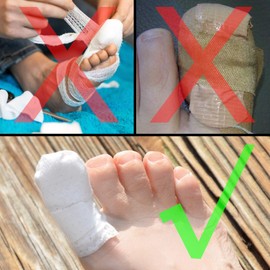 MediMitt ToeMitt Big Toe Bandages Non-Adhesive (Full Coverage Big Toe Bandage) (Without Absorbent Pad, X-Large (Pack of 10))