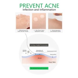 Parches Hidrocoloides Antiacné Acne Patche Tratamiento Facial Día/Noche
