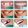 Temporary Crown for Front and Rear Teeth Resin Temporary Crown