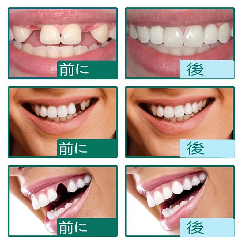 Temporary Crown for Front and Rear Teeth Resin Temporary Crown