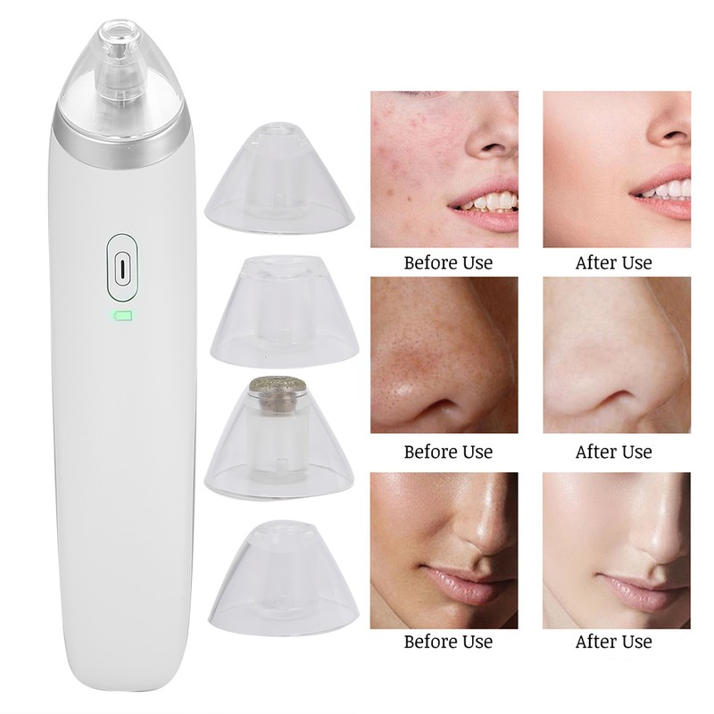 Electric 4‑In‑1 Blackhead Removal Pore Cleaner Suction USB Charging Face