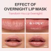 SPODARE Lip Mask, Hydrating Overnight Lip Sleeping Mask, Lip Moisturizer