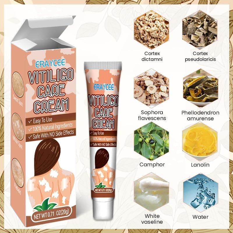 Vitiligo Cream, Natural Effective Vitiligo Treatment for Reduce White Spots