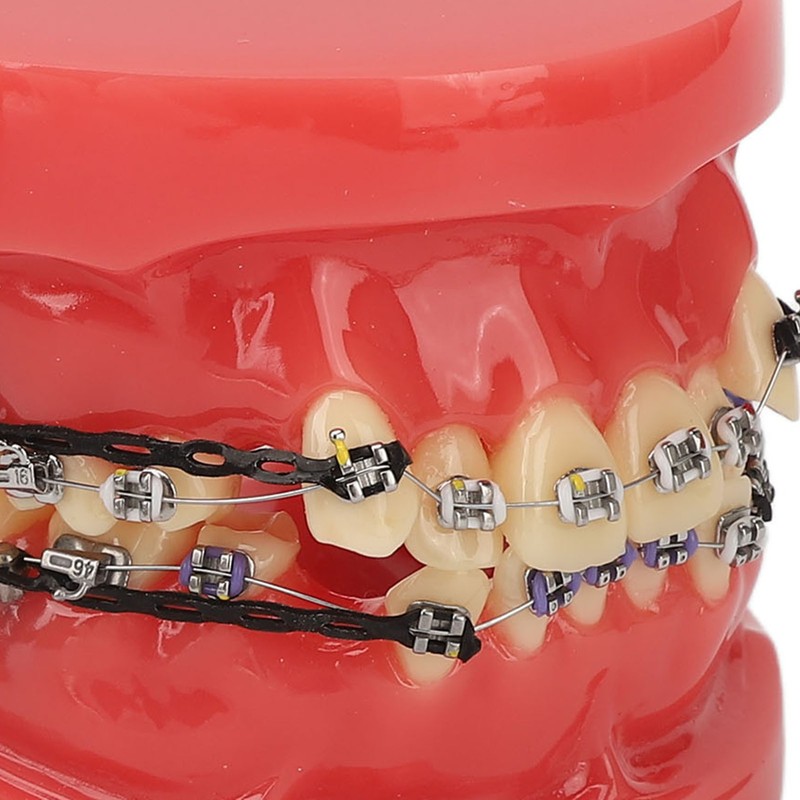 Professional Dental Demonstration Orthodontic Model with Metal Wires and Bracket