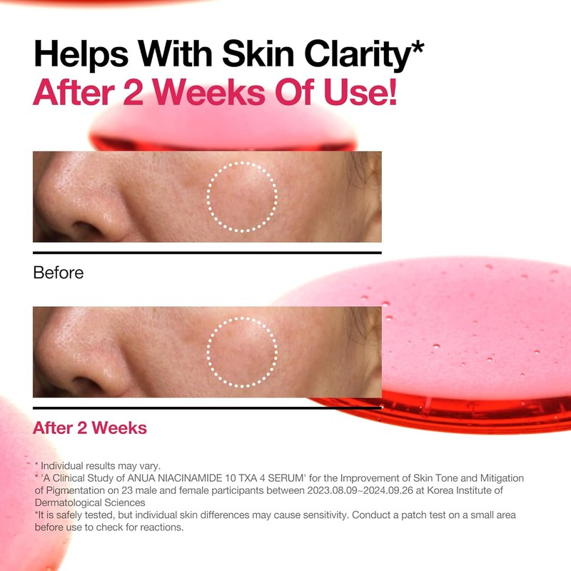 Anua [Anua]*renewal* Niacinamide 10% + TXA 4% Dark Spot Correcting