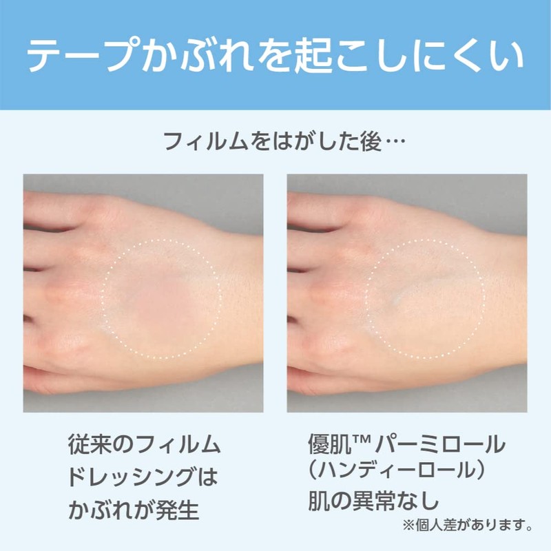 Nitoms H24R10 Yu-Skin Permirol, 3.9 inches (10 cm) x 32.8