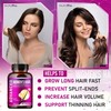 Hair Growth Vitamins for Women - Hair Vitamins for Thinning