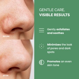 PLANTIFIQUE Korean Glycolic Acid Pads with CICA, 60 Pcs - AHA, BHA, PHA Face Exfoliating Pads for Gentle Skin Renewal - Toner Pads for Cleansing All Skin Types - Vegan Formula & Refillable Container