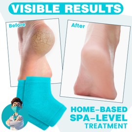 TEAWOO 3 Pairs Fuzzy Moisturizing Heel Socks for Cracked Heel Treatment, Toeless Socks for Women & Men, Cracked Heel Repair, Hydrate Dry Cracked Feet Heels (Blue)