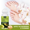 Cracked Foot Cream Roll-On Moisturizer, 1.76floz