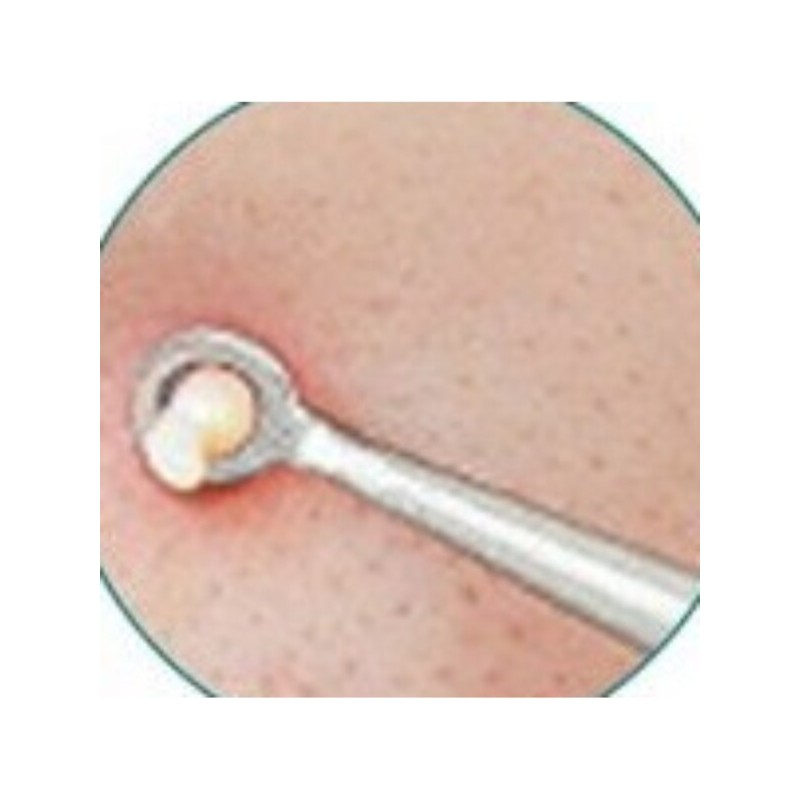 뾰루지짜기 등드름압출 초등학생코피지 볼블랙헤드 턱화이트헤드 Pimple Squeezing Back Acne Extraction
