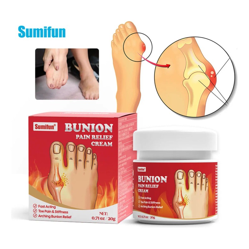 Para Ungüento Para El Dolor De Juanetes, Pomada Para El