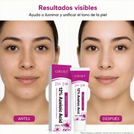 Crema Ácido Azelaico 12% Contra Acné Manchas Del Rostro