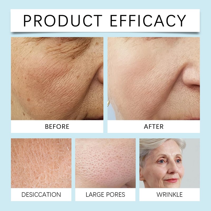 Tkekruh Facial Pack, Set of 8 Face Masks for Sebum