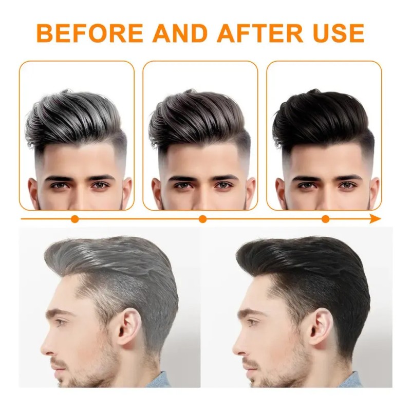 Champú Y Jabón De 4 Piezas Para Cubrir El Cabello