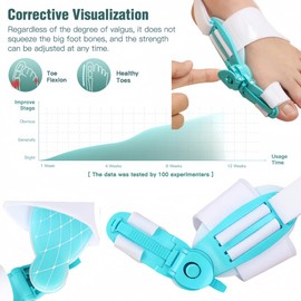 BOSHIZL Adjustable Bunion Relief Corrector for Women & Men Big Toe Straightener Fix Orthoses (1pcs, White blue)