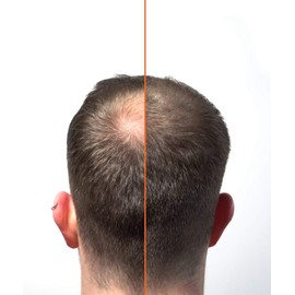 HairLab 100% Organic Hair-Thickening Keratin Fibres for Concealing Hair Loss and Thinning Hair - 15g Medium Brown