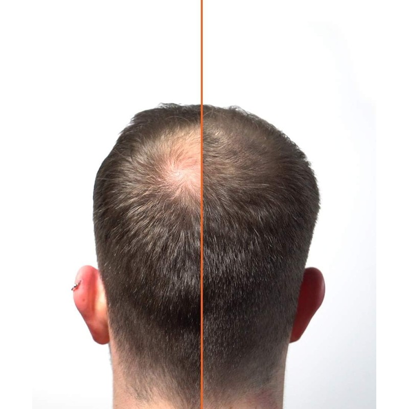 HairLab 100% Organic Hair-Thickening Keratin Fibres for Concealing Hair Loss