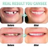 2 Pairs, Temporary Nature and Comfortable, Regain Confident Smile for