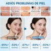 Kit Moisture Trío Antiedad Hidratante Calma Repar Piel Joven
