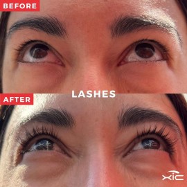 Tratamiento Para Crecimiento De Pestañas Xic Enhancer
