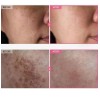 Dr. Althea 0.1% Gentle Retinol Serum 30ml Todo Tipo De