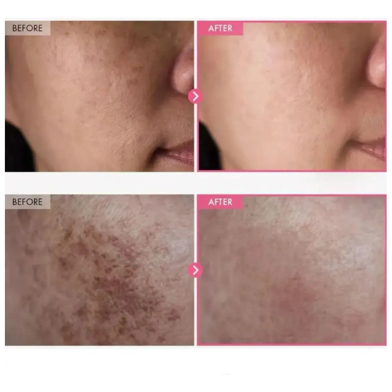 Dr. Althea 0.1% Gentle Retinol Serum 30ml Todo Tipo De