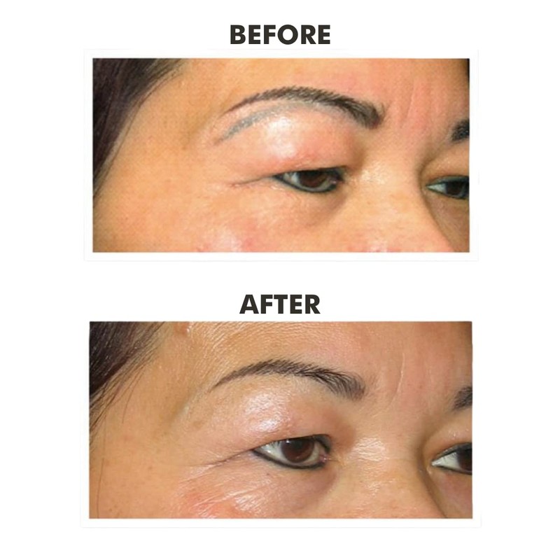 Biotouch COLOR LIFT Microblading Eyebrow Supplies Color Remover Unwanted Pigment