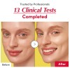 Suero Facial Con Vitamina C Y Niacinamida Iluminador